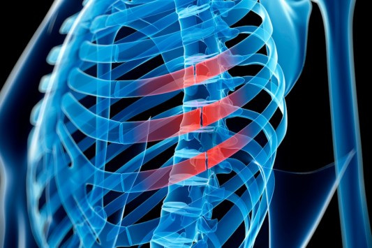 pop-music-star-fractures-rib