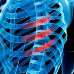 pop-music-star-fractures-rib