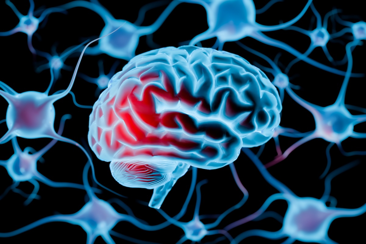Comedian to Undergo Brain Surgery After Doctors Discover Tumors